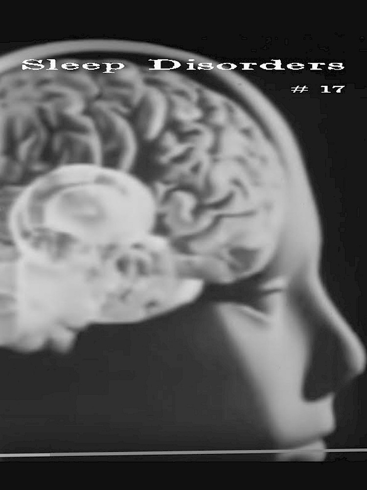 Sleep Disorders #17